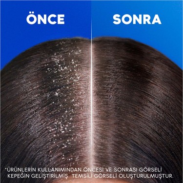 Head&Shoulders Head&Shoulders Klasik Bakım Şampuanı 800 ml Tüm Saç Tipleri için Kepeğe Karşı — 5. ürün görseli
