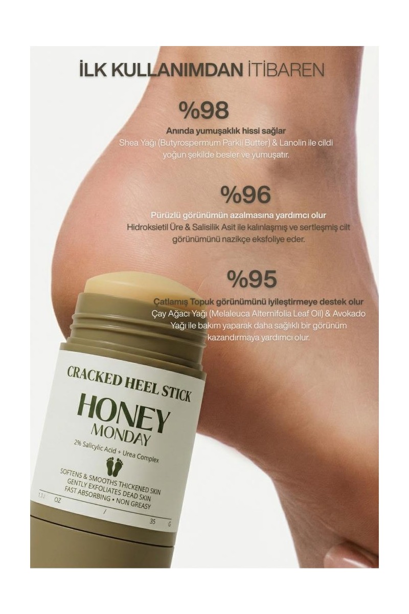 Honey Monday Ayak ve Topuk Çatlak Bakımı | Ayak Kokusu , Sertleşmiş Pürüzlü Topuklar Için Kompleks Formül 35 gr
