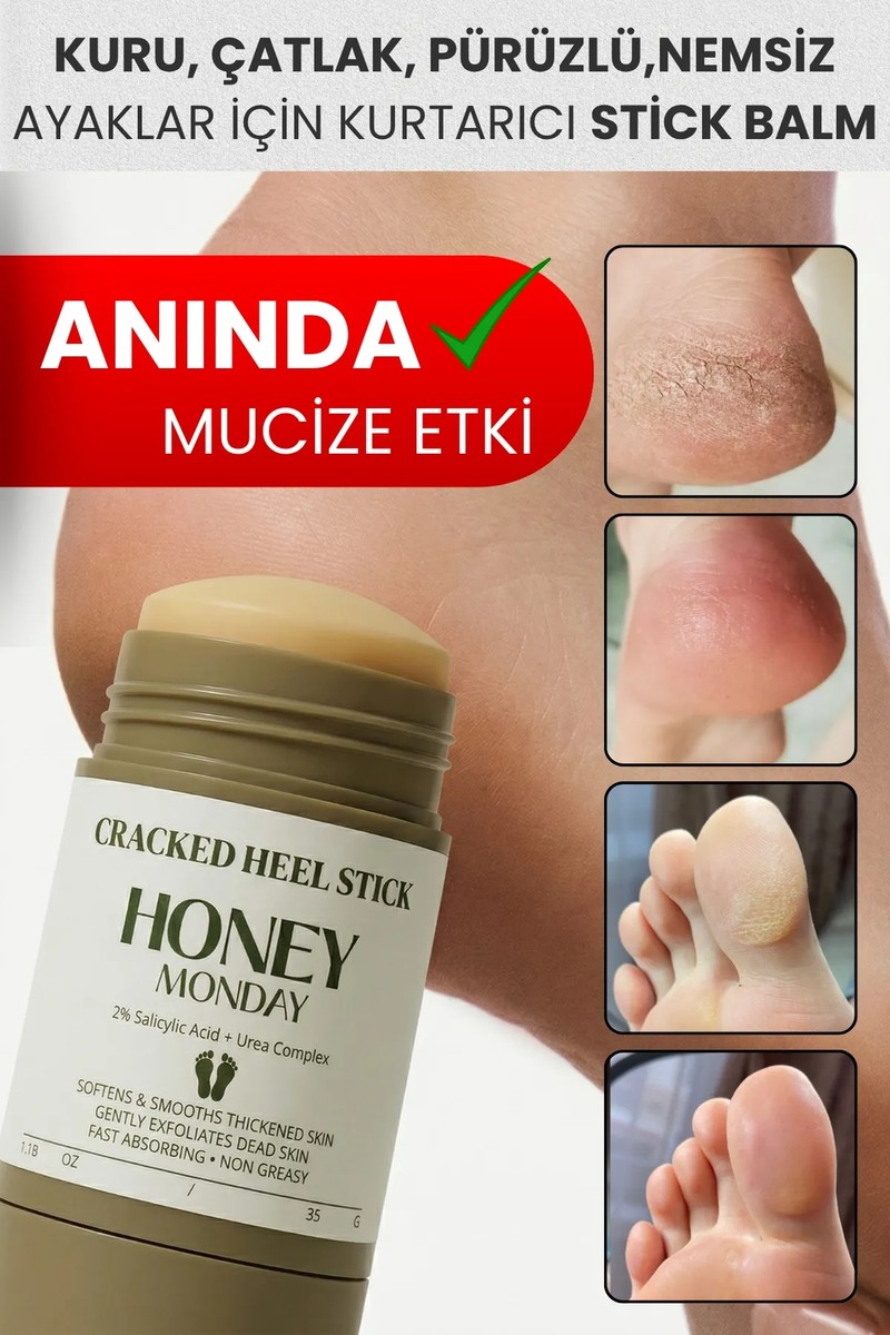 Honey Honey Monday Ayak ve Topuk Çatlak Bakımı | Ayak Kokusu , Sertleşmiş Pürüzlü Topuklar Için Kompleks Formül 35 gr — 2. ürün görseli