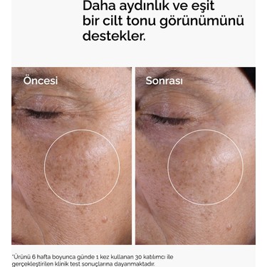 The Ordinary The Ordinary Glycolic Acid 7% Exfoliating Toner - Aydınlatmaya ve Pürüzsüzleştirmeye Yardımcı Tonik — 2. ürün görseli