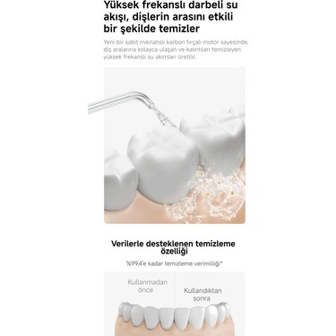 Xiaomi Xiaomi Water Flosser 2 Şarjlı Ağız Duşu – 2 Başlıklı, Basınç Dengeleme, Yüksek Frekans ve Uzun Pil — 4. ürün görseli